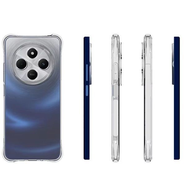 TPU чохол GETMAN Ease посилені кути Full Camera для Xiaomi Redmi 14C / Poco C75 555-02488 фото